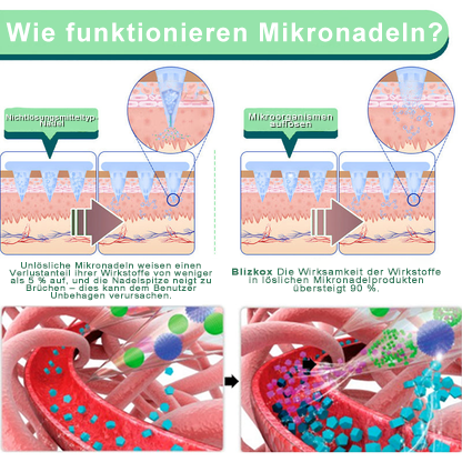 🔥【Letzter Aktionstag – 60 % RABATT! 🔥】Blizkox® ✨𝑨𝒅𝒆𝒍𝒈𝒂𝒛𝒂𝒎𝒊𝒆𝒏𝒕𝒐 𝑷𝑨𝑹𝑪𝑯𝑬 𝑫𝑬 𝑵𝑨𝑵𝑶𝑴𝑰𝑪𝑹𝑶𝑨𝑮𝑼𝑱𝑨𝑺 👑(Schmerzlose, kontinuierliche Wirkung für 24 Stunden | Schneller Gewichtsverlust: bis zu 9 kg | Senkt den Blutzucker um bis zu 90 %)15